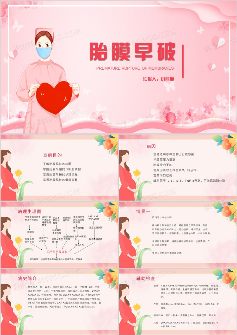 卡通风胎膜早破护理查房胎膜早破PPT模板