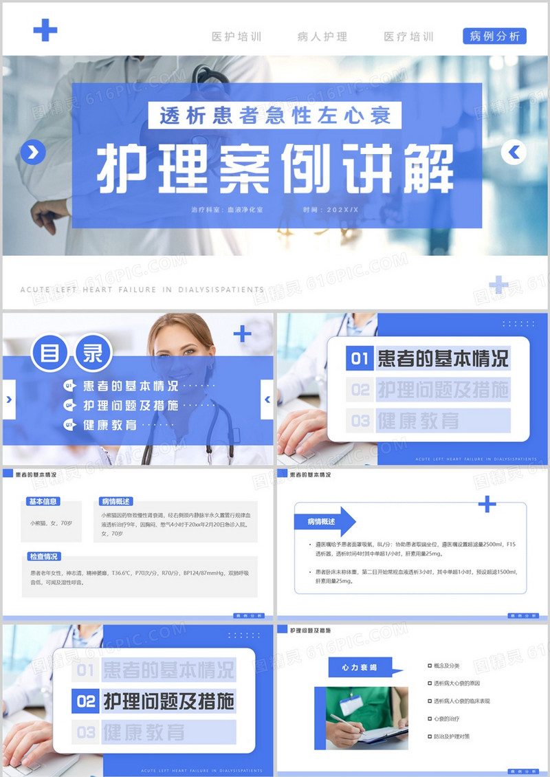 蓝色简约风透析心衰病人护理案例讲解PPT模板