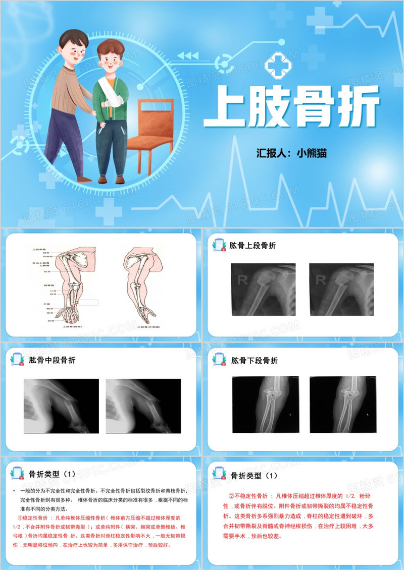 蓝色上肢骨折护理查房PPT模板