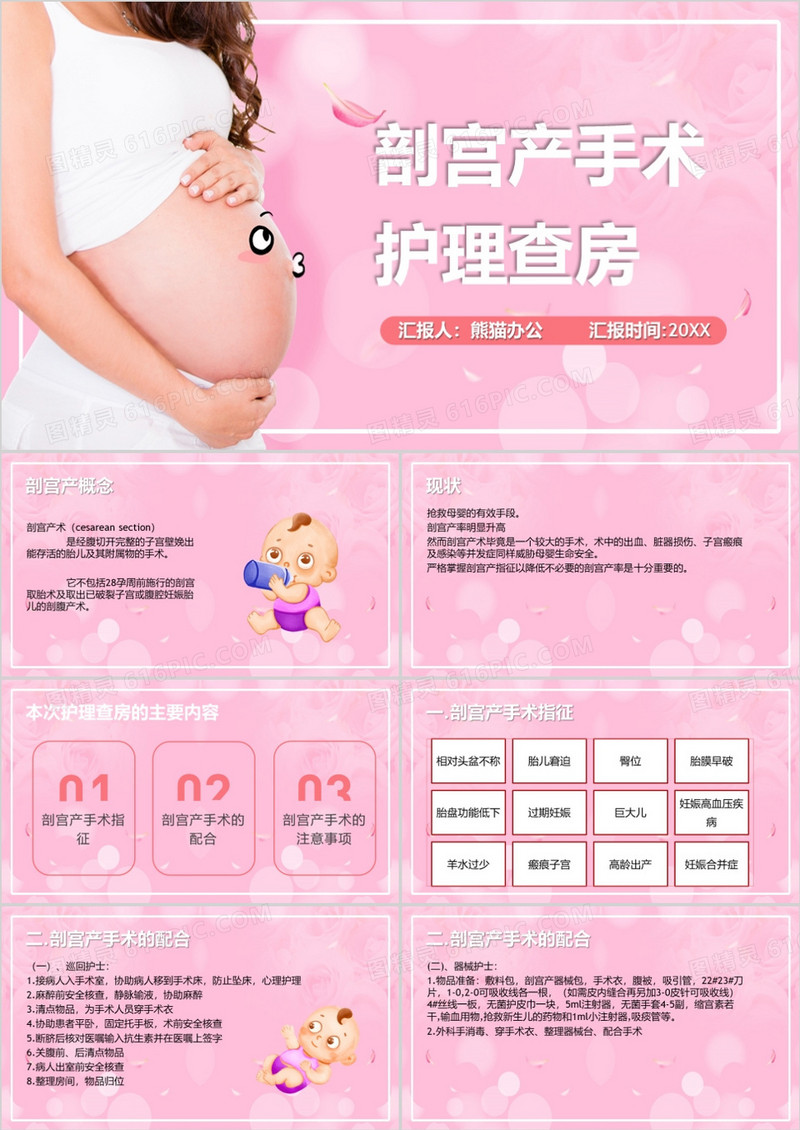 剖宫产手术护理查房PPT模板