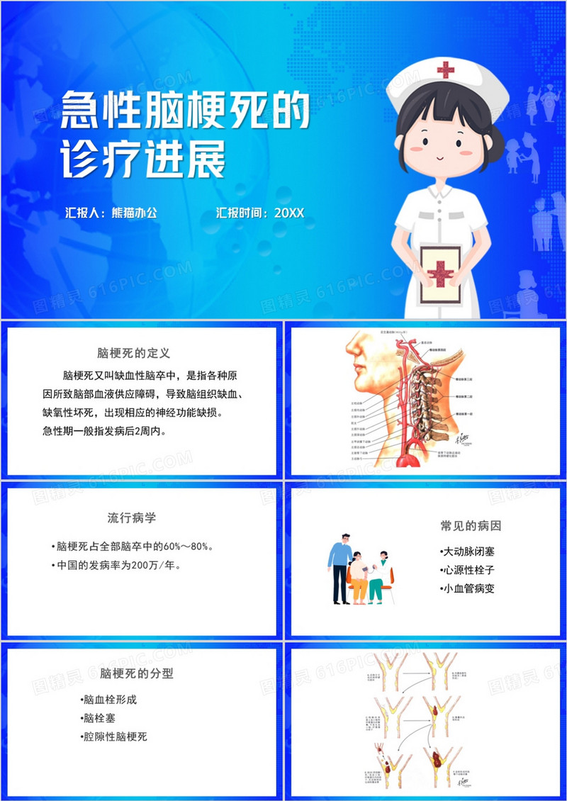 急性脑梗死的诊疗进展脑梗死护理查房PPT模板