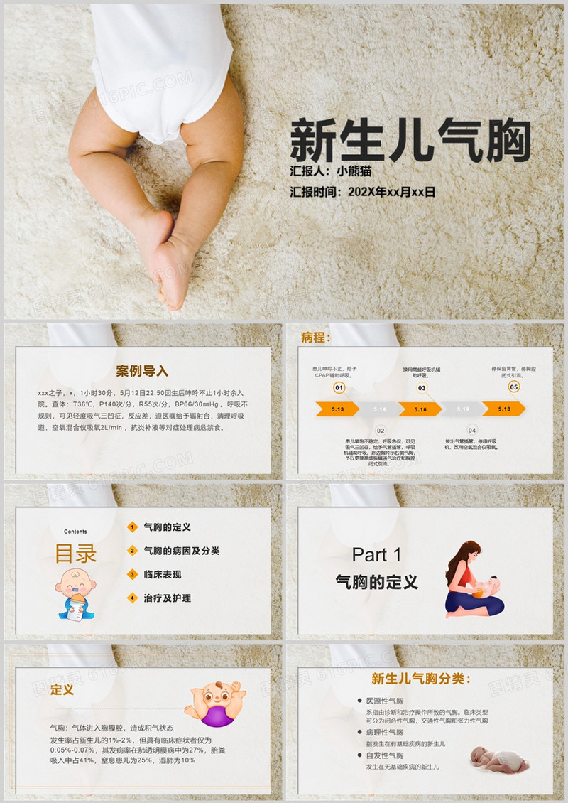 新生儿气胸护理查房气胸患者PPT模板