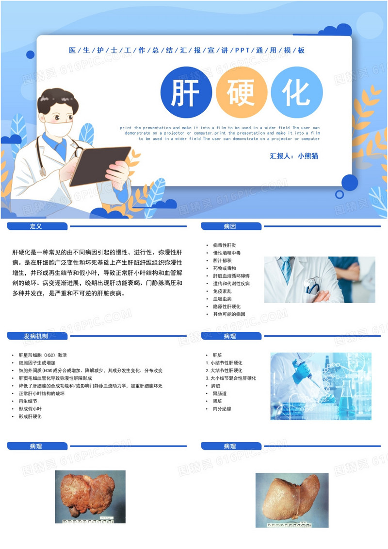 简约蓝色卡通风肝硬化介绍PPT模板