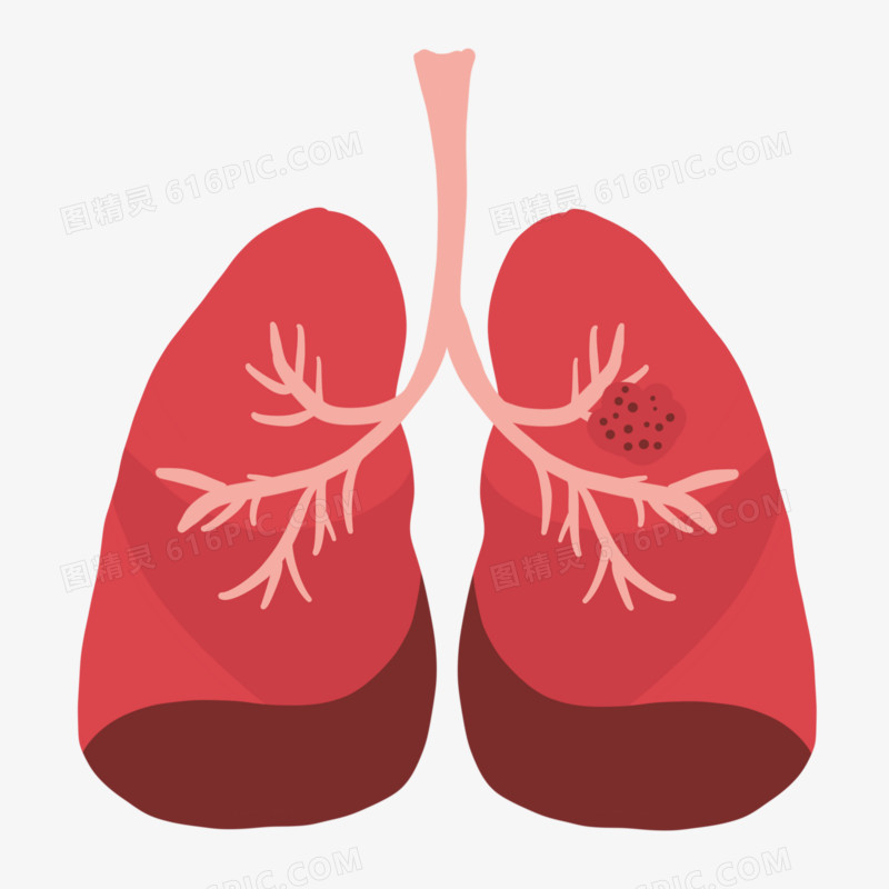 卡通手绘肺部肿瘤免抠元素