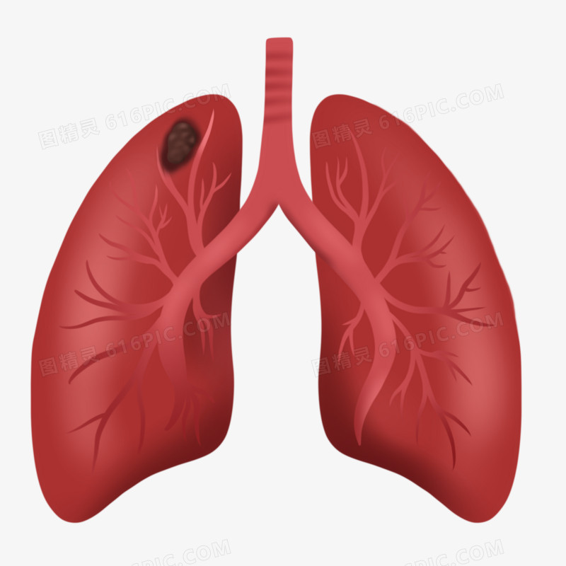 卡通手绘肺癌元素