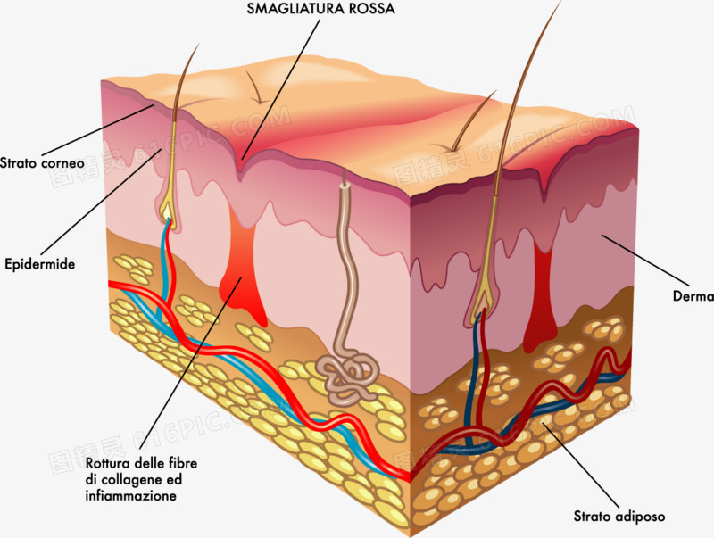 人体皮肤结构分析图