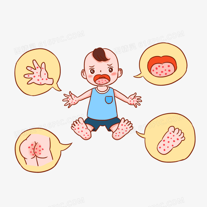一组婴儿手足口病发病症状套图免抠元素