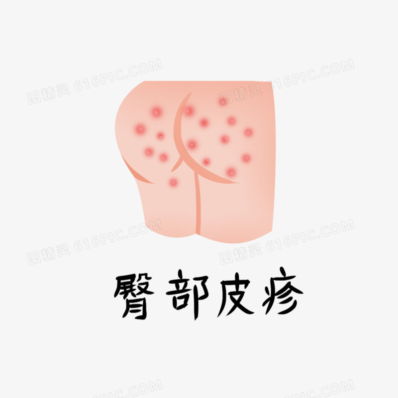 一组手绘插画手足口病发病症状合集元素二