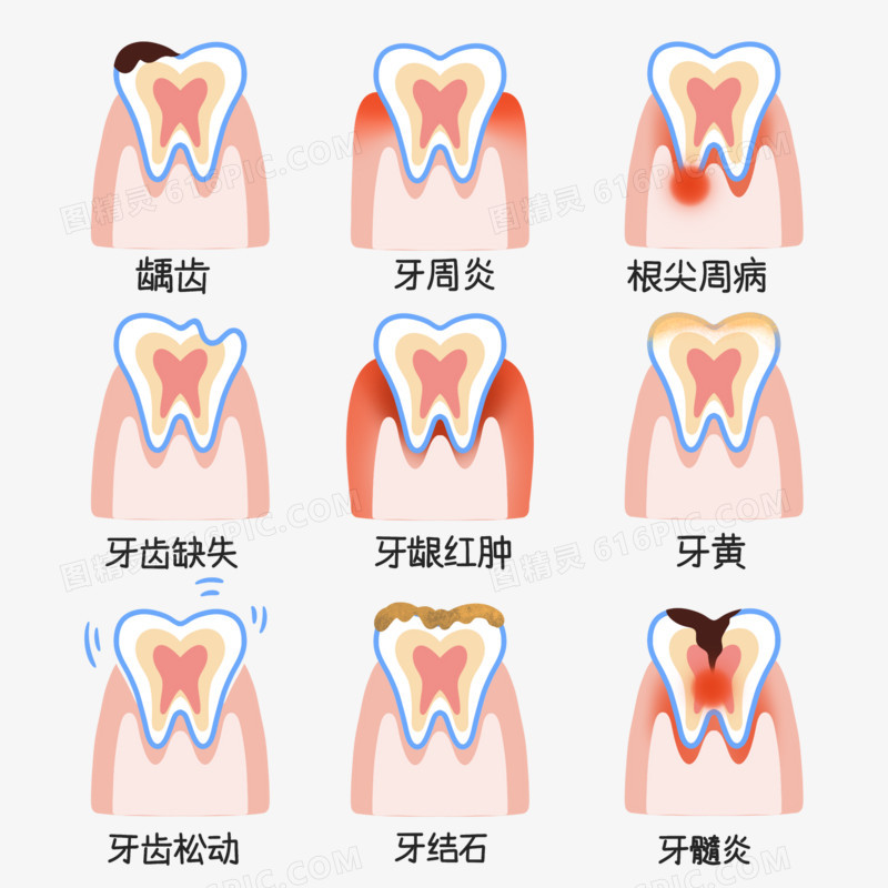 一组牙齿口腔疾病套图合集元素
