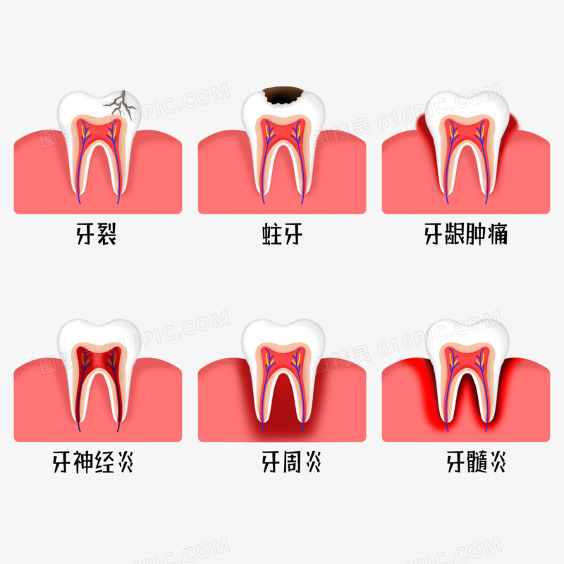 一组牙齿疾病元素套图