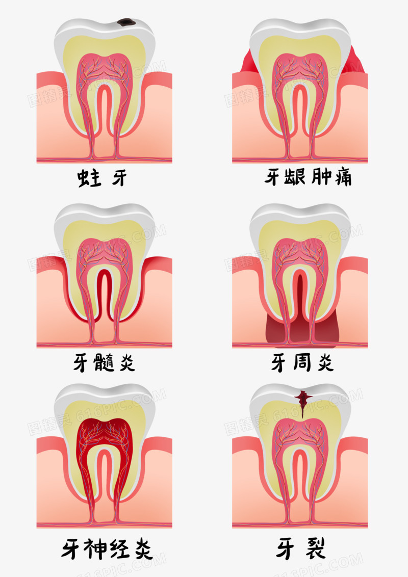 一组手绘牙齿疾病卡通套图合集元素