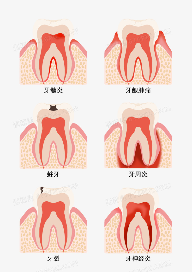 一组牙齿疾病剖面图合集元素