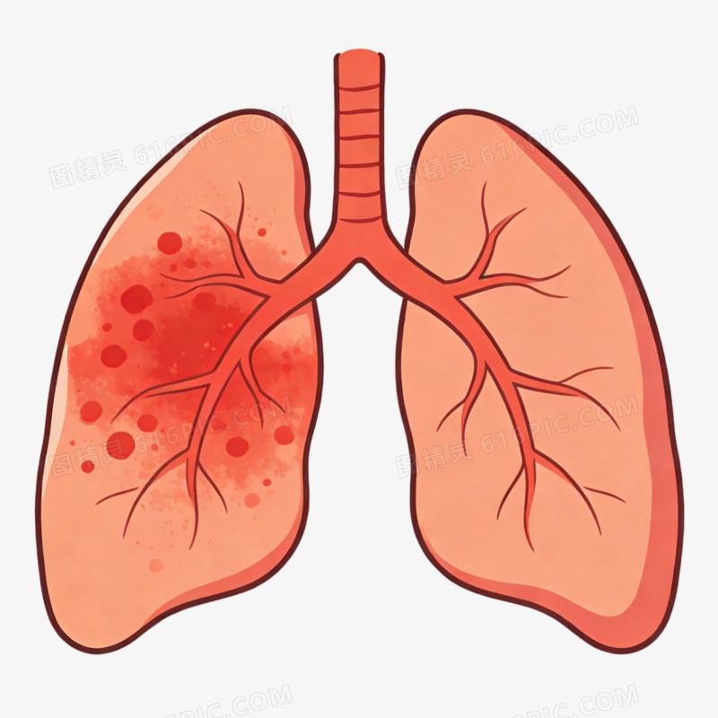 肺部感染的插图ai免抠元素